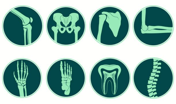 التشوهات الخلقية